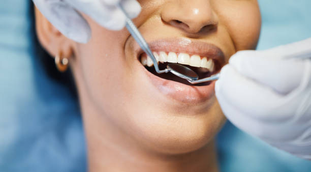 Best Chipped Tooth Repair Near Me  in Reisterstown, MD